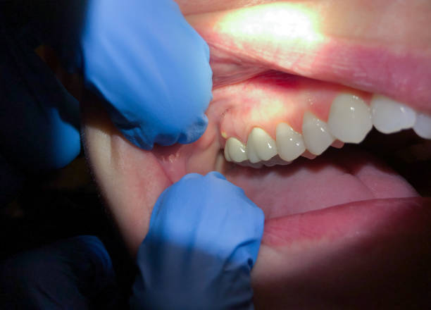Best Emergency TMJ Treatment in La Crescent, MN