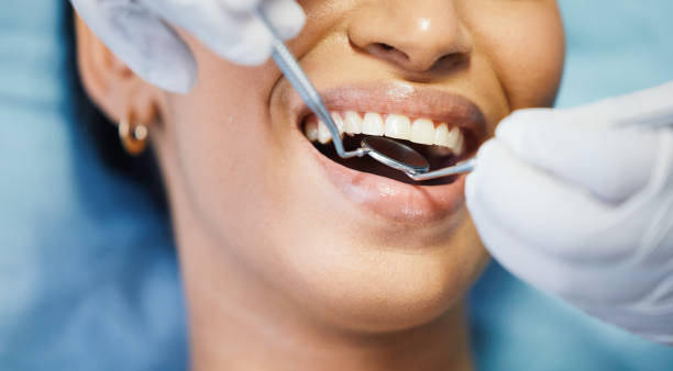 Best Emergency Treatment for Dental Infections or Abscesses in La Crescent, MN