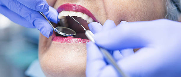 Best Emergency Dental Care for Broken or Chipped Teeth in La Crescent, MN